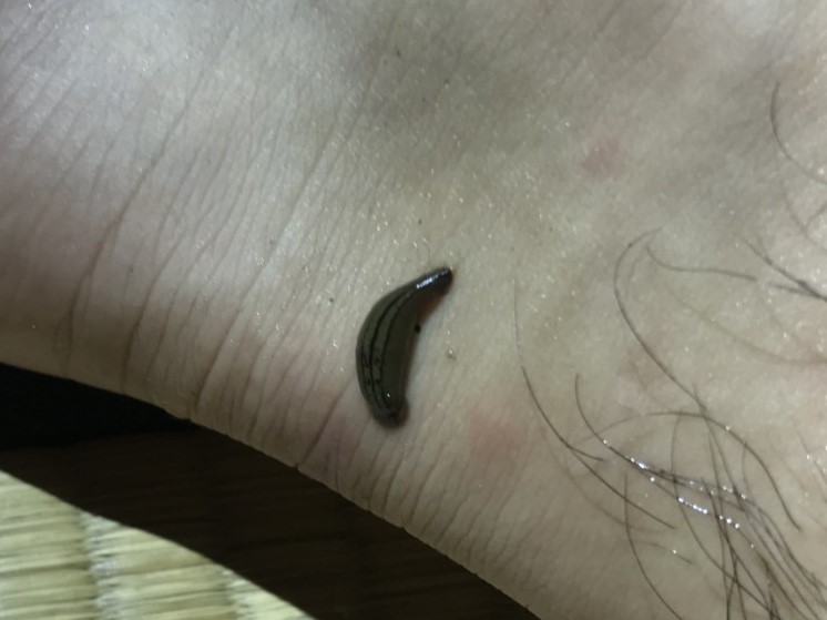 足に吸着しているヤマビルの様子（吸血中）